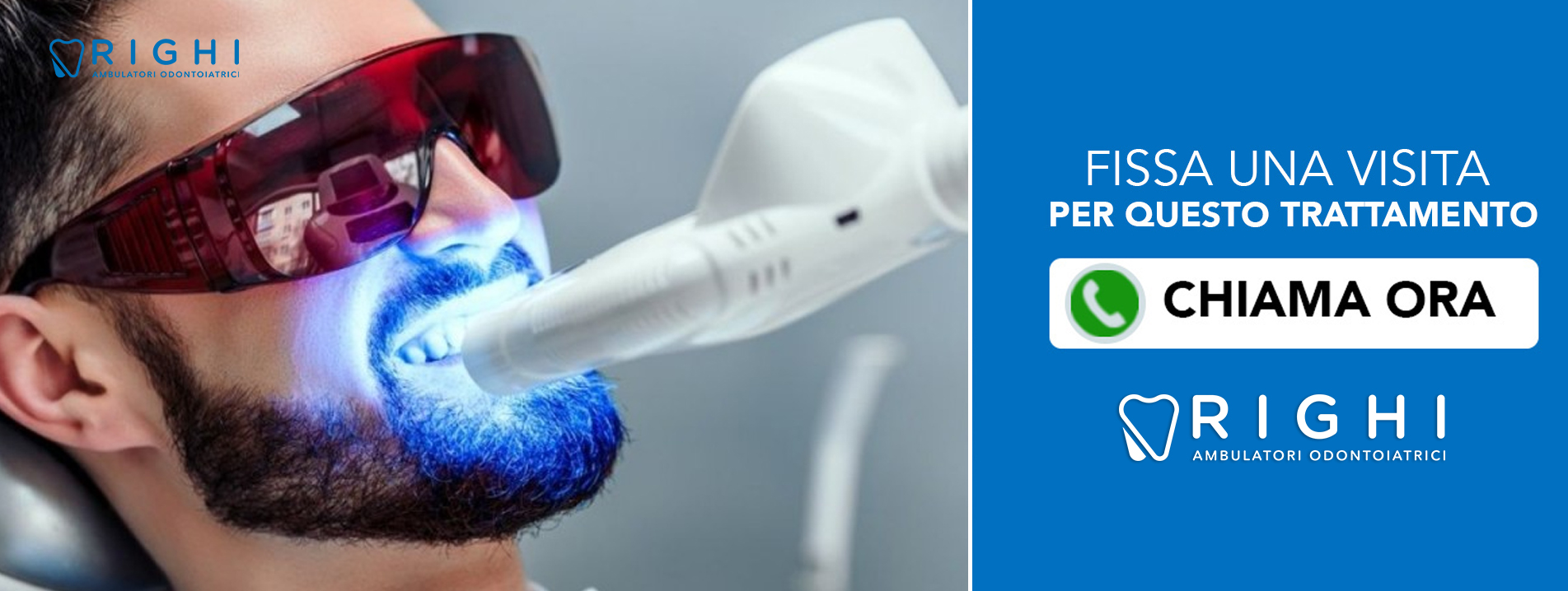 Lampada Sbiancamento dentale dentista Rivalta (Reggio Emilia)