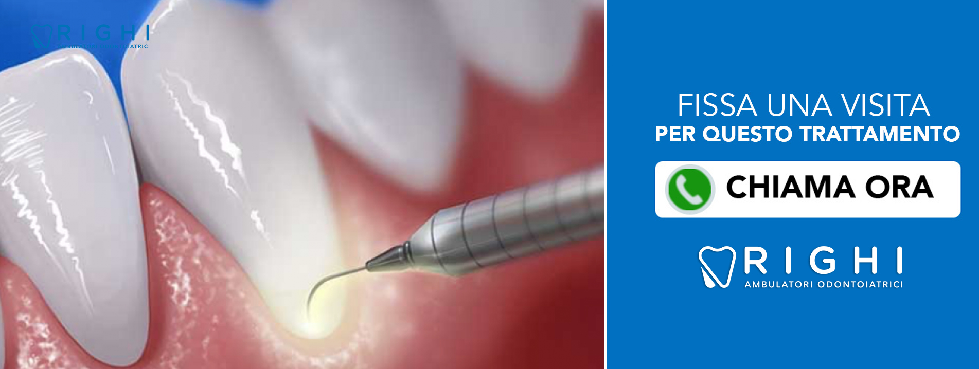 Laser dentista Rivalta (Reggio Emilia)