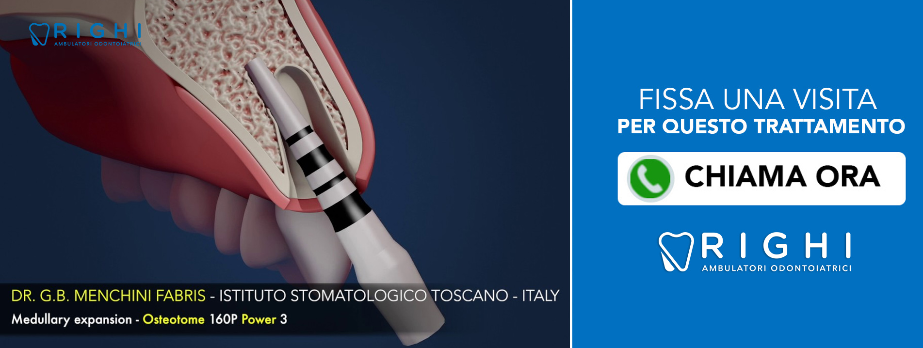 MagneticMallet dentista Rivalta (Reggio Emilia)