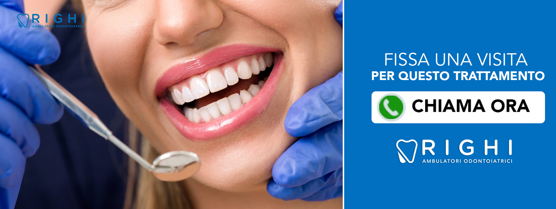 apicectomia-dentista-Rivalta (Reggio Emilia)