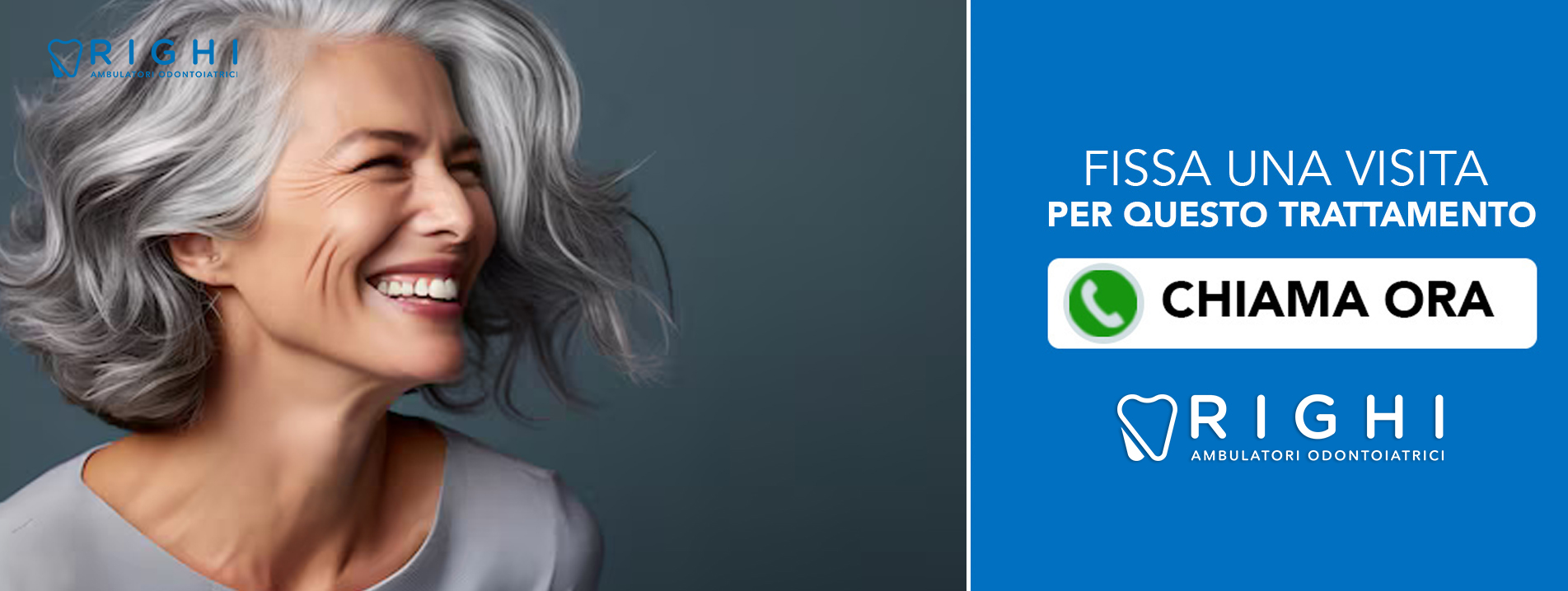 Impianti Zigomatici-dentista-Rivalta (Reggio Emilia)