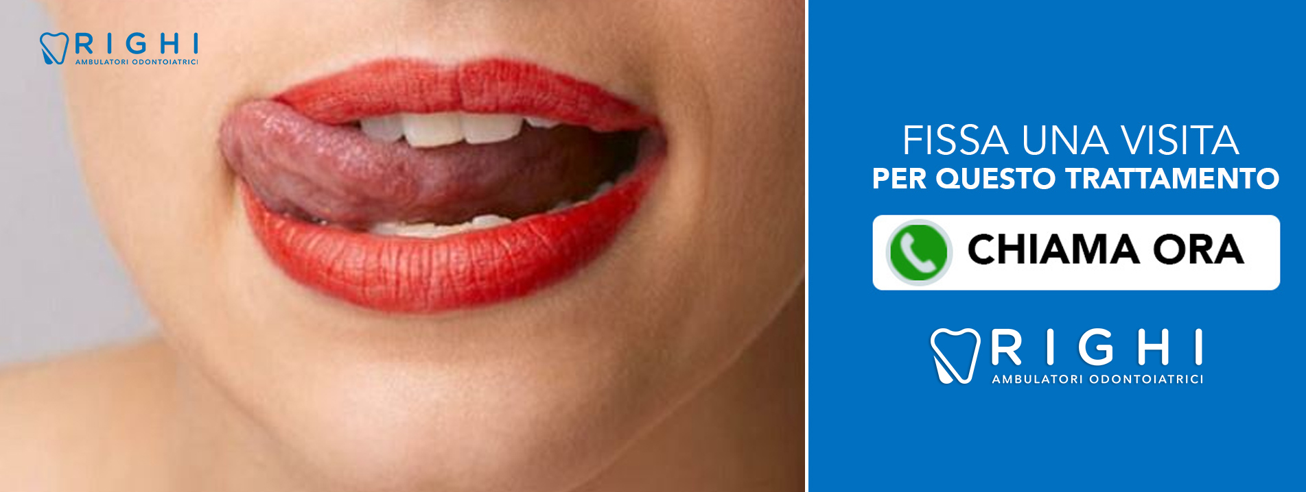 Cura-herpes-dentista-Rivalta (Reggio Emilia)