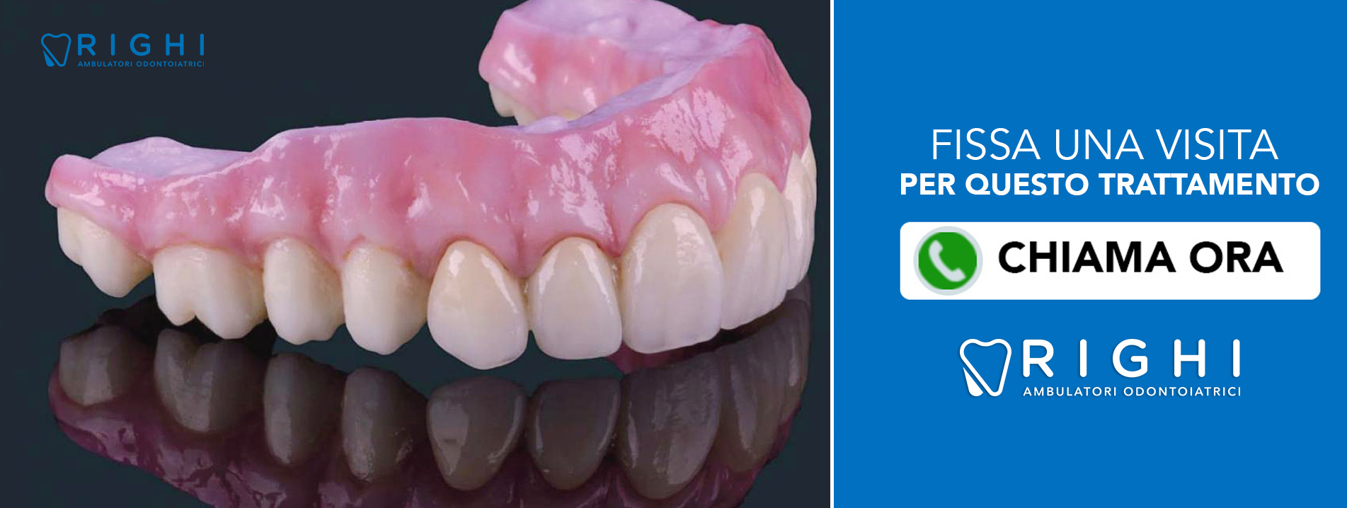 protesi-mobile-fissa-dentista-Rivalta (Reggio Emilia)