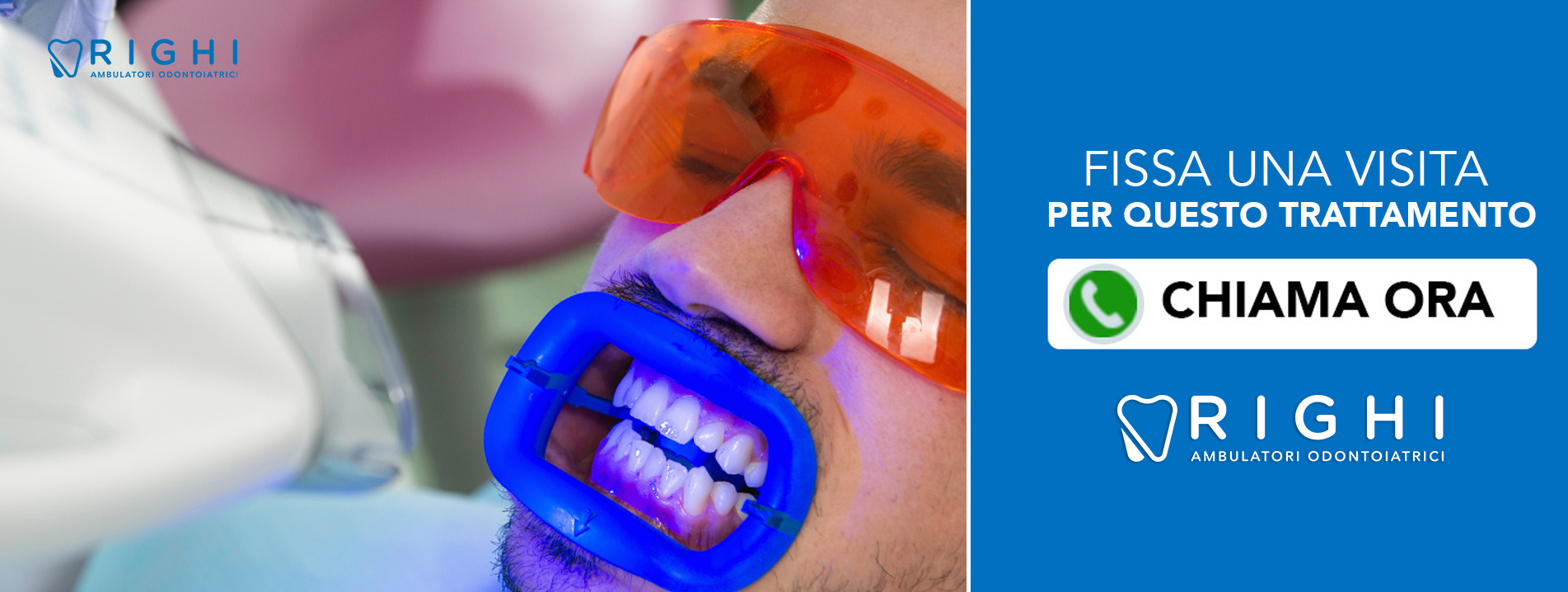 sbiancamento-dentista-Rivalta (Reggio Emilia)